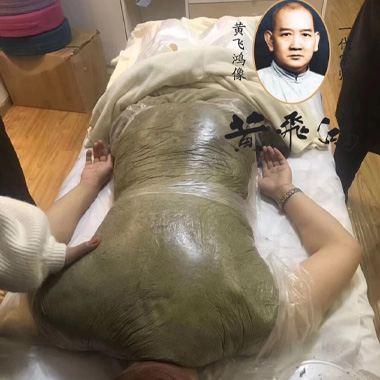 黃飛鴻熱灸膏調理案例