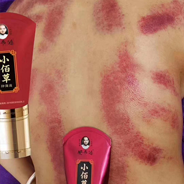   黃飛鴻小佰草抑菌液刮痧案例